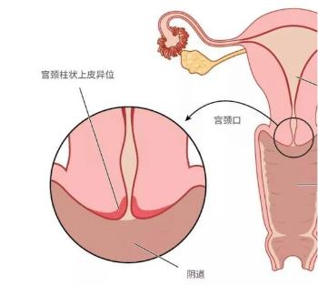 男人怎么知道顶到宫颈了,大概多少cm能到子宫