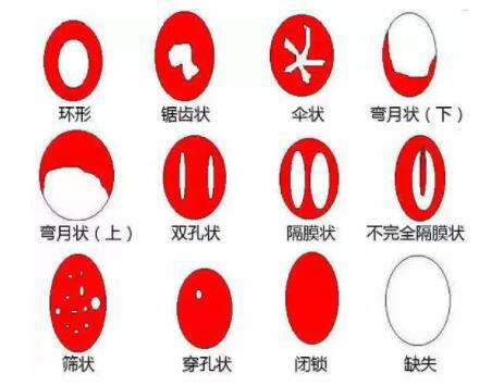 怎么样看自己破没破？用手是不是也属于第一次没了