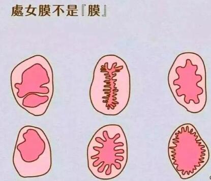 怎么样看自己破没破?用手是不是也属于第一次没了