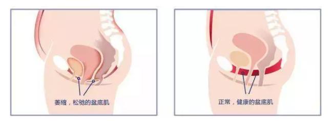 怎么知道自己下面松不松,放几个手指说明松了