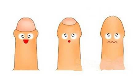 包茎过长不割可以吗？