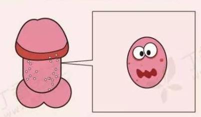 男人丁丁上有白色的米一样是什么东西？是性病么