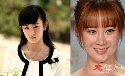 张檬整容记图片判若两人 变化好大而且整残了