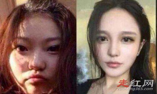 凤姐个人信息 整容后现在长什么样