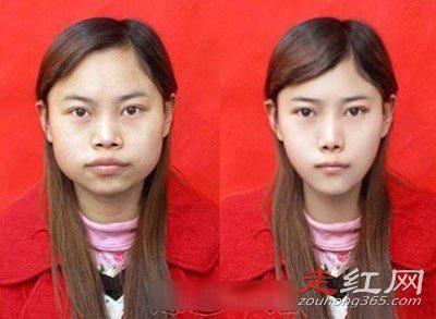 凤姐整容了吗 80万整容后照片对比