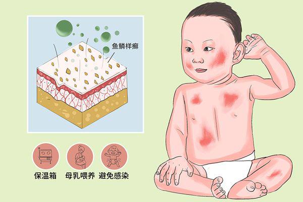 火棉胶婴儿痛苦吗 长大后和正常人一样吗