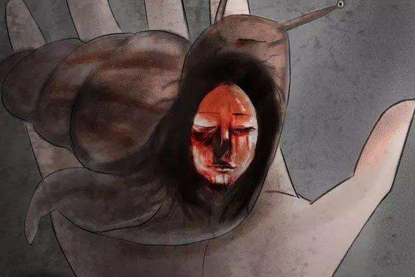 蜗牛人的真实图片 漩涡真人版看了让人呕吐不止