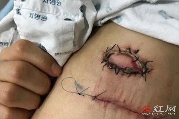 韩艺瑟医疗事件 男友是牛郎怎么回事