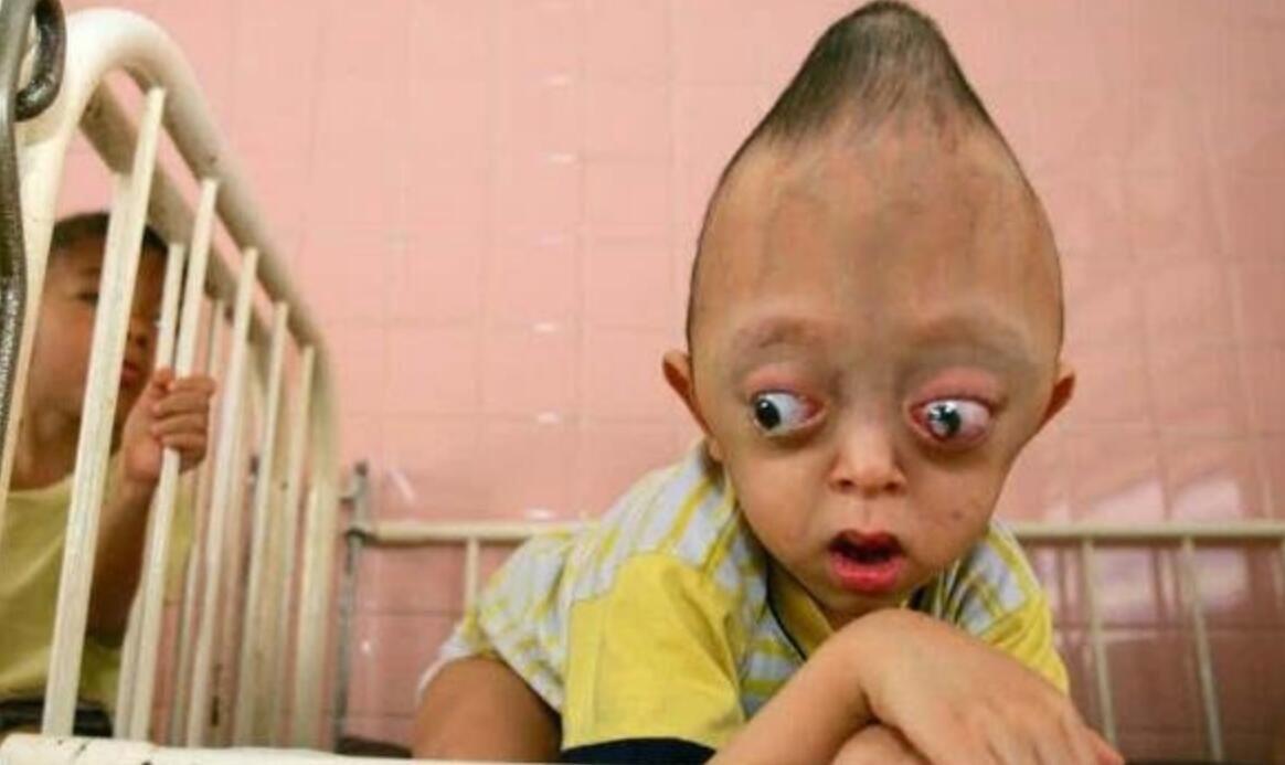 日本核电站福岛变异人照片曝光：辐射幽灵婴儿