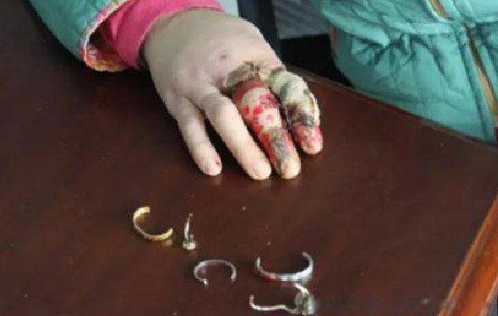 戴戒指打保龄球的图片原图吓人 血腥恐怖的后果