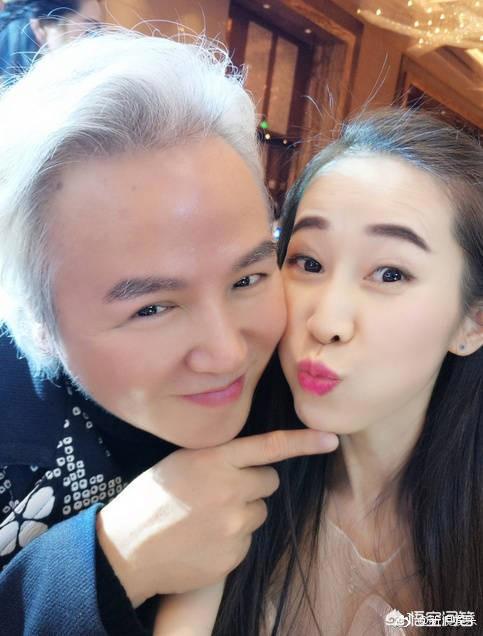 林瑞阳为什么满头白发 张庭老公像老奶奶