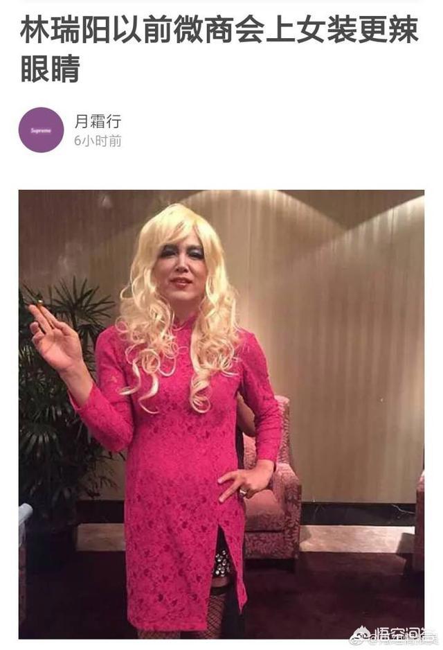 林瑞阳为什么满头白发 张庭老公像老奶奶