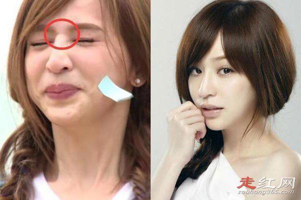 王心凌为什么突然消失了 每次出现脸部都不一样