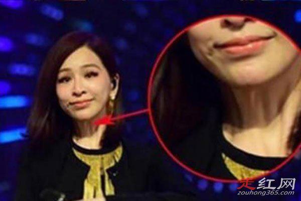 王心凌为什么突然消失了 每次出现脸部都不一样