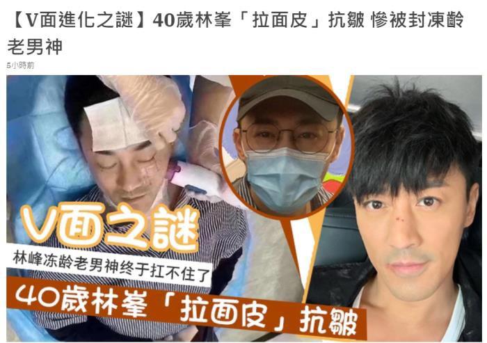林峰是不是整容了 与小11岁的老婆张馨月敷面膜搞怪