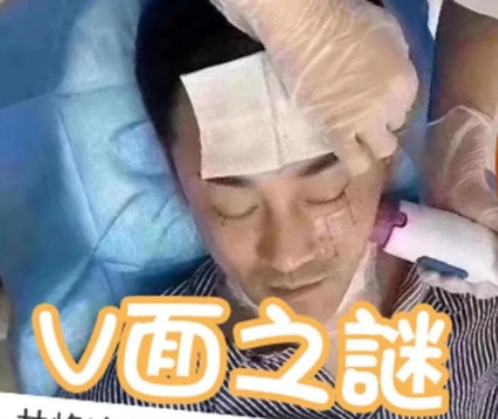 林峰是不是整容了 与小11岁的老婆张馨月敷面膜搞怪