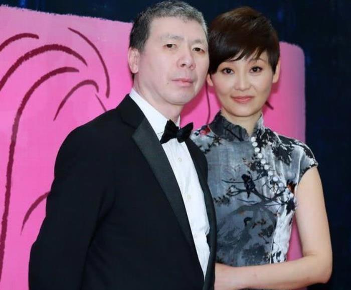 冯小刚的白斑是怎样治好的 难以治愈索性放弃治疗