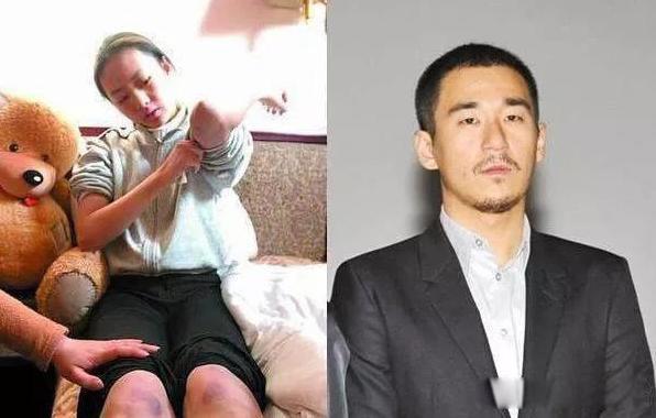 演员童瑶个人资料简介 童瑶张默事件真相分手原因