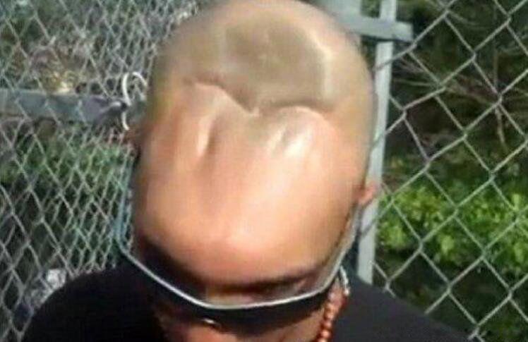 半脑哥智商高正常吗 为什么可以存活到现在的原因