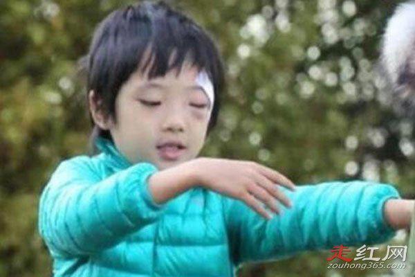 费曼眼睛怎么伤的 打闹的时候被推到磕在了桌角上