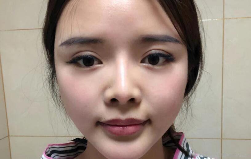 最丑的鼻子类型图片 四大鼻型是什么样子的