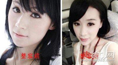 姚芊羽变了一张脸 整容过度脸变残