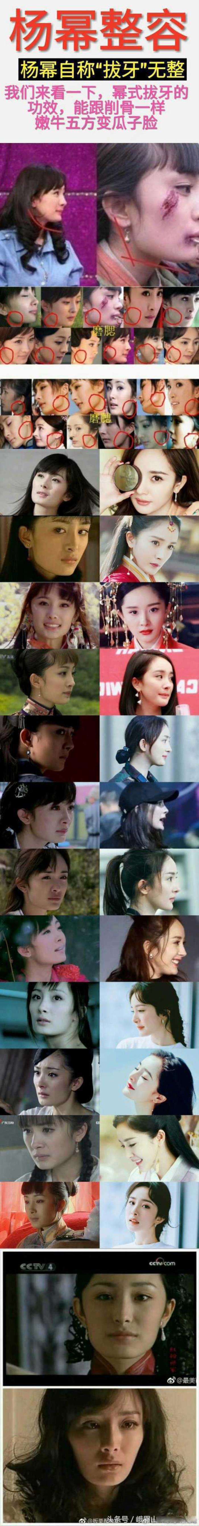 杨幂到底有没有整容 脸型的变化史是怎么变的
