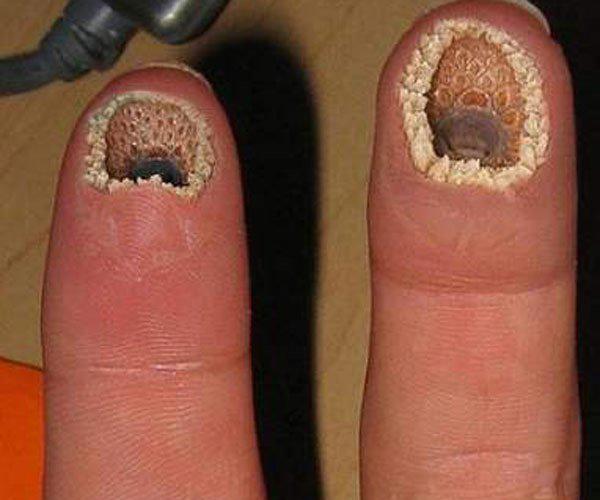 莲蓬乳,空空指,微笑狗,牙膏脸是什么 造成视觉上的不适感