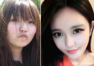 周扬青以前的样子图片 整容是因为什么