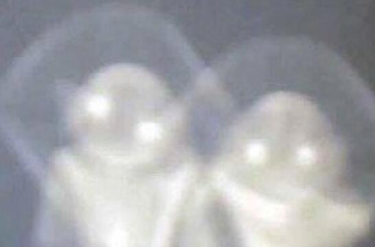 七大外星人图片真实照片 神秘尸体是什么样子的