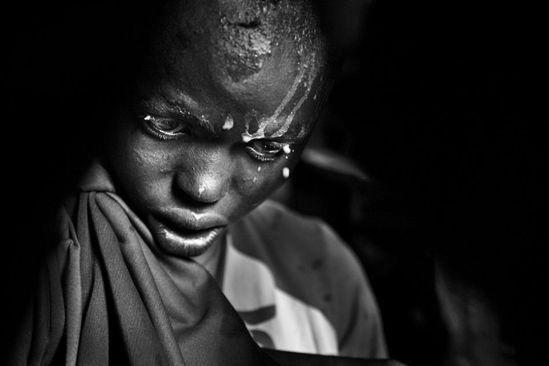 割礼是什么样的图片 非洲女孩割礼是怎么一回事(意义和目的)