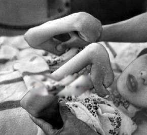 日本水俣病事件主要污染物是什么 包含哪些环境影响