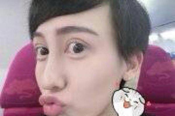 刘梓晨以前长啥样 融掉玻尿酸之后是什么样子呢