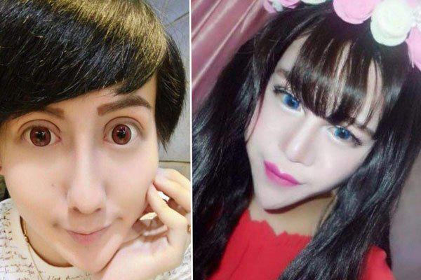 刘梓晨以前长啥样 融掉玻尿酸之后是什么样子呢