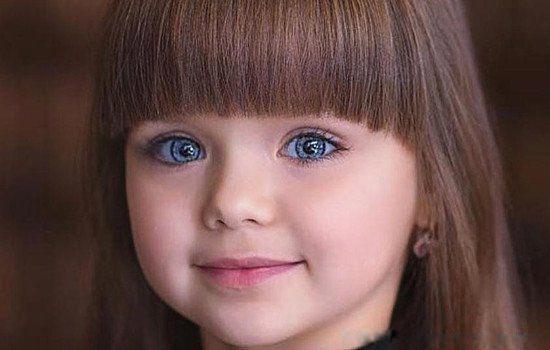 歌舞伎综合症患者图片 是什么病成年后真的漂亮吗