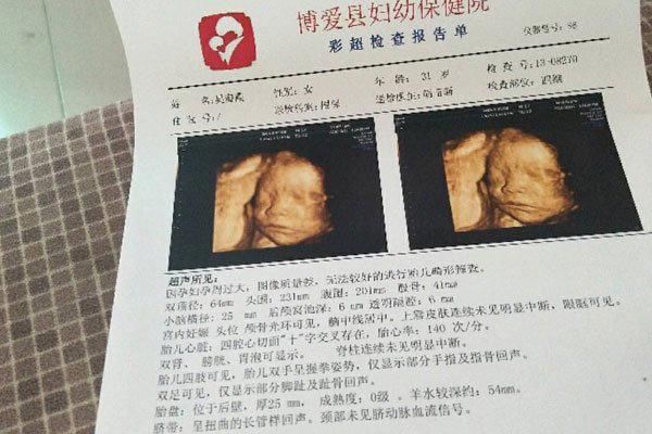 医生说怀男孩的特点 三个特征有一个就是重男轻女