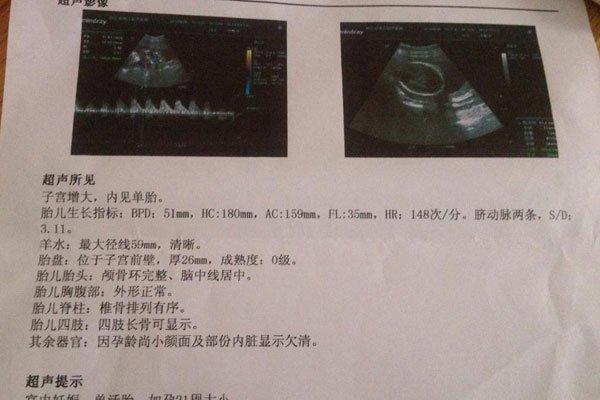 医生说怀男孩的特点 三个特征有一个就是重男轻女