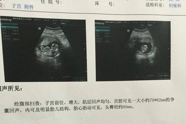 医生说怀男孩的特点 三个特征有一个就是重男轻女