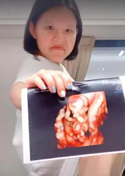谢依霖宣布二胎再次怀孕，大方晒出宝宝成型照片