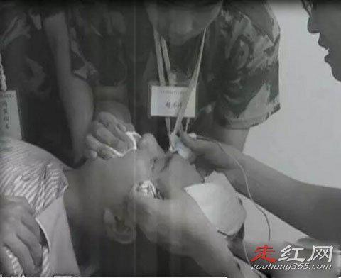 杨永信最后怎么处理的 电击治疗事件被法律制裁了嘛