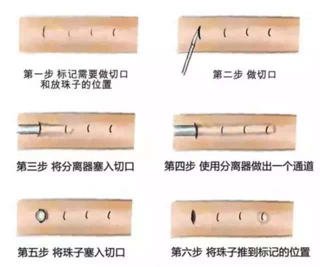 J8镶钻？不，那叫入珠