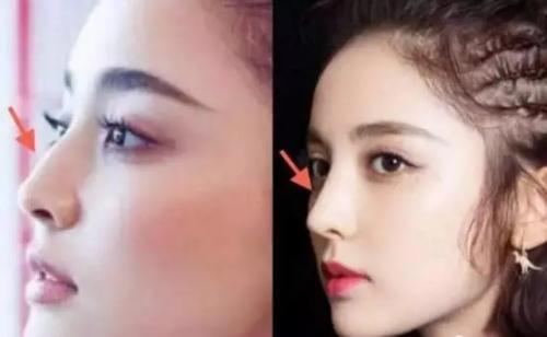 古力娜扎的电视剧合作窦骁再次扑街 娜扎图片整容前后对比引热议