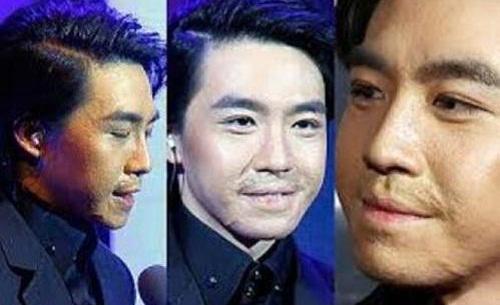 俞灏明烧伤前后对比细节 俞灏明和Selina怎么烧伤的事件始末