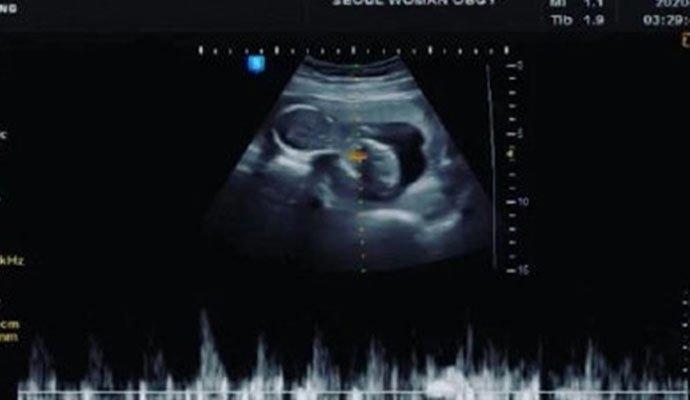 具荷拉事件是什么哥哥如今发文回应 具荷拉怎么死的最新消息曝光