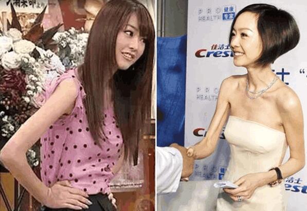 桐谷美玲没有生理期体重轻得吓人 宣布结婚后胖到颜值巅峰