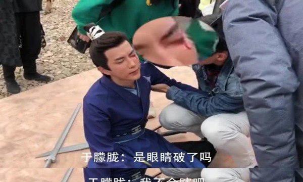 于朦胧女朋友是谁？于朦胧因戏眼睛受伤演过的电视剧有哪些