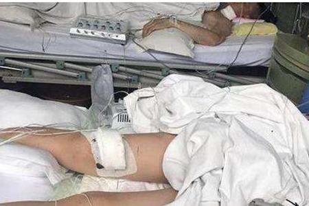 女童被继父连砍4刀确诊高位截瘫，高位截瘫大小便怎么办能恢复吗？