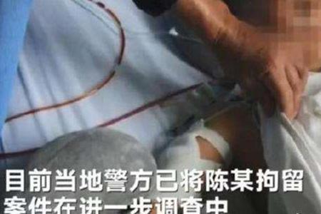 女童被继父连砍4刀确诊高位截瘫，高位截瘫大小便怎么办能恢复吗？