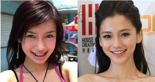 angelababy整容前后照片对比 颜值遗传了父母