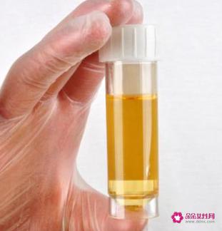 糖尿病早期10个征兆